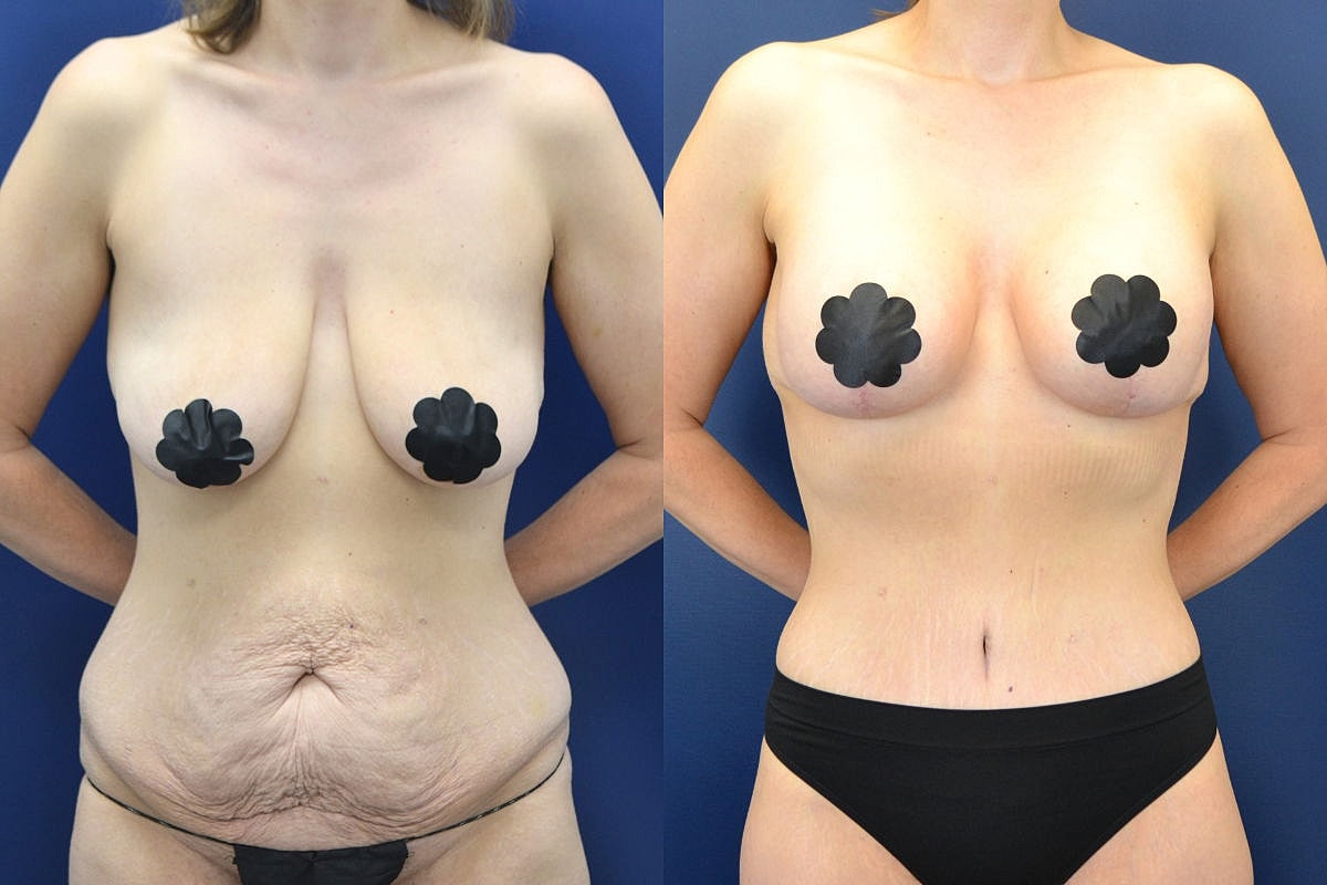 Before and after body transformation images.