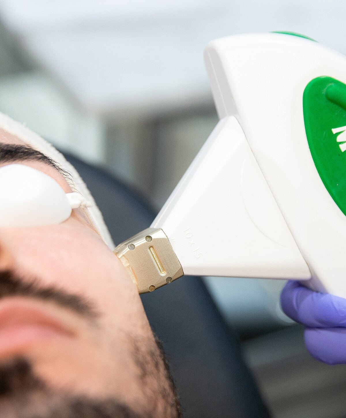 Facial treatment using laser technology on skin.
