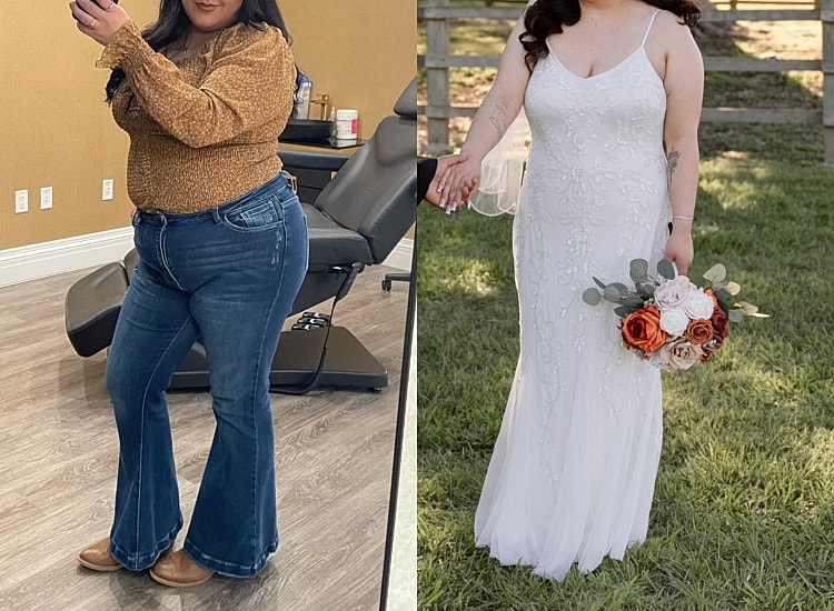 Medical Weight Loss Before & After
