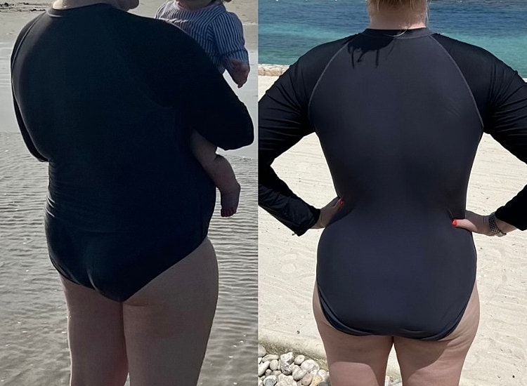 Medical Weight Loss Before & After