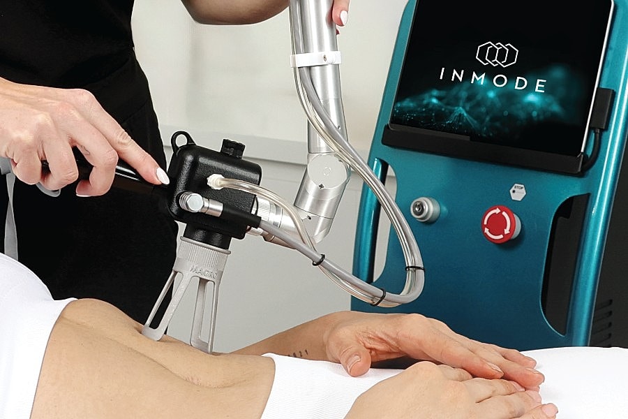 Laser treatment procedure in medical clinic setting.